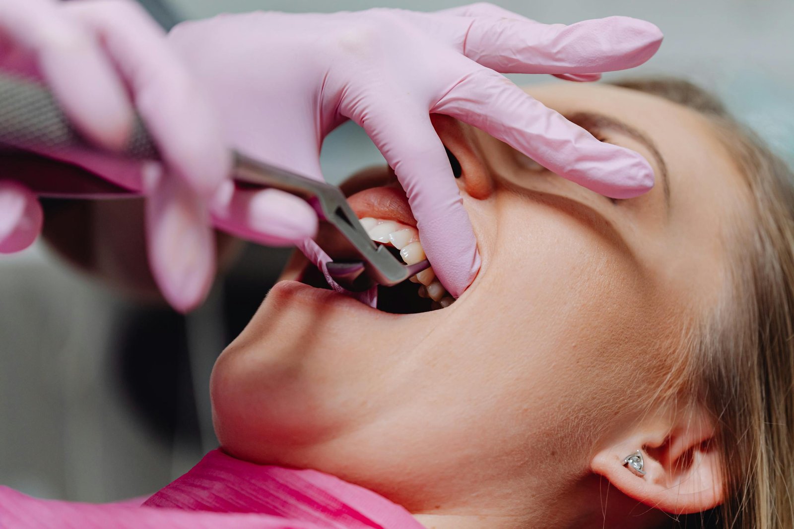 Rotten Teeth Dream Meaning